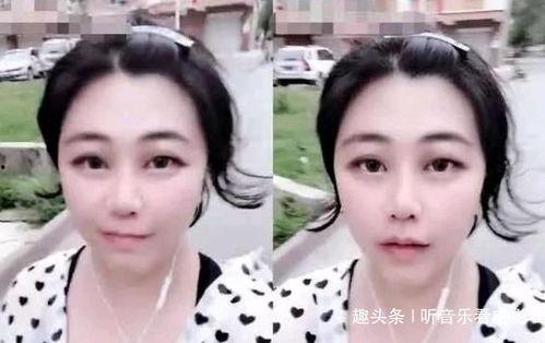 娱乐吃瓜酱鼻梁变高,揭秘明星整形新趋势